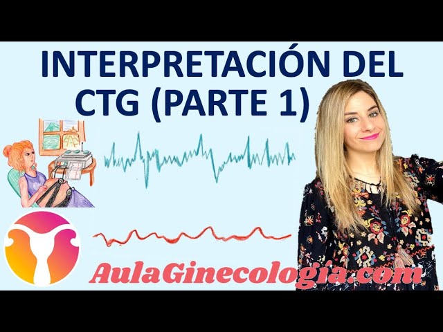 como se leen las contracciones como entender monitor contracciones