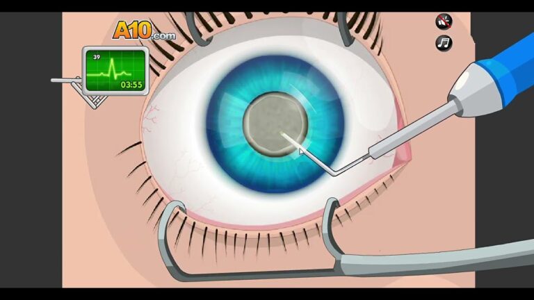 operate now cirugia de ojo